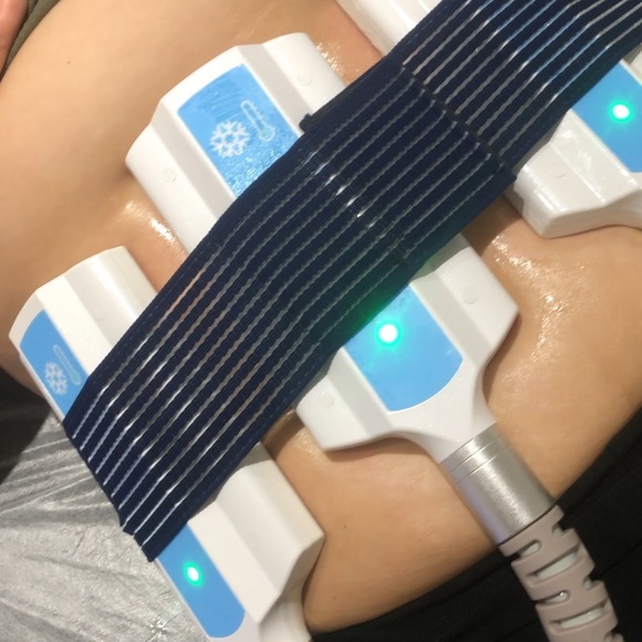 Cryosculpting Machine - Picture 7 of 12